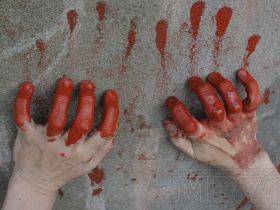Потеря крови. Фото с сайта mr7.ru